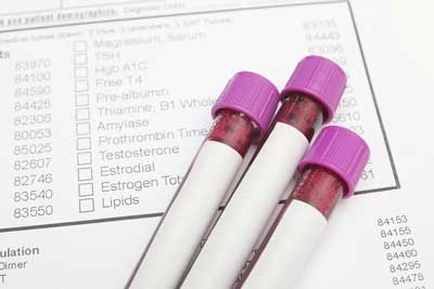 Low Cost Blood Profiles - Portsmouth Drive-thru