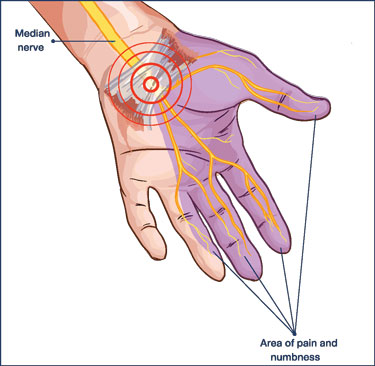 hand nerves image 